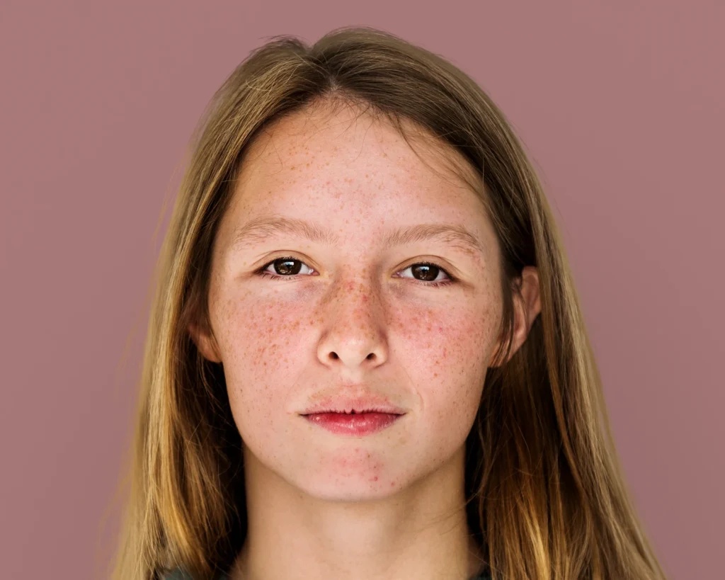 What Is Rosacea? How Skincare and MedSpa Treatments Can Help